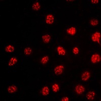 TBX15/18 Rabbit Polyclonal Antibody