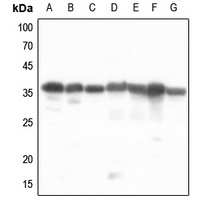 PDLIM1 Rabbit Polyclonal Antibody