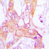 PDLIM1 Rabbit Polyclonal Antibody