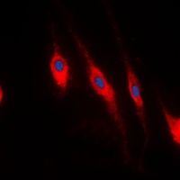 PDLIM1 Rabbit Polyclonal Antibody