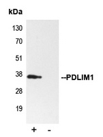PDLIM1 Rabbit Polyclonal Antibody