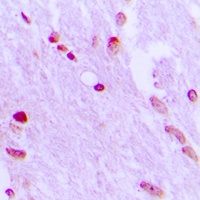 AIFM1 Rabbit Polyclonal Antibody