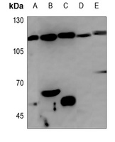 GEF H1 Rabbit Polyclonal Antibody