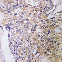 GEF H1 Rabbit Polyclonal Antibody