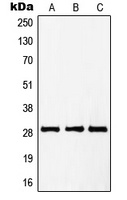 PTTG1/2/3 Rabbit Polyclonal Antibody