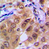 PTTG1/2/3 Rabbit Polyclonal Antibody