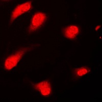 PTTG1/2/3 Rabbit Polyclonal Antibody