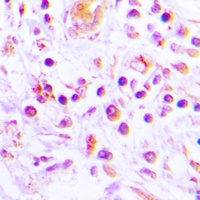 IL-32 Rabbit Polyclonal Antibody