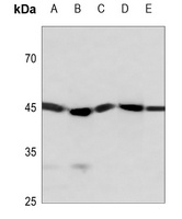 STK17B Rabbit Polyclonal Antibody