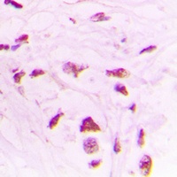 STK17B Rabbit Polyclonal Antibody