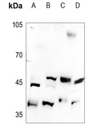 B4GALT5 Rabbit Polyclonal Antibody
