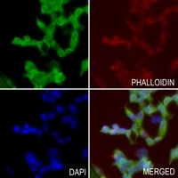 B4GALT5 Rabbit Polyclonal Antibody