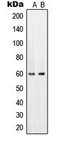 PAHT Rabbit Polyclonal Antibody