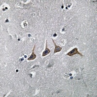 PAHT Rabbit Polyclonal Antibody