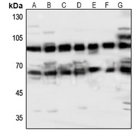 ABCG2 Rabbit Polyclonal Antibody