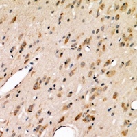 ABCG2 Rabbit Polyclonal Antibody