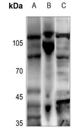 ADAMTS2 Rabbit Polyclonal Antibody