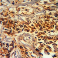 ADAMTS2 Rabbit Polyclonal Antibody
