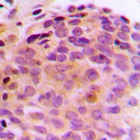 BAG4 Rabbit Polyclonal Antibody