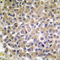 p130 Cas (Phospho-Y249) Rabbit Polyclonal Antibody