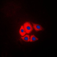 p130 Cas (Phospho-Y249) Rabbit Polyclonal Antibody