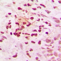 NCOR1 Rabbit Polyclonal Antibody