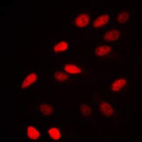 NCOR1 Rabbit Polyclonal Antibody