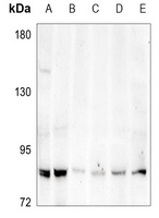 ABCG1 Rabbit Polyclonal Antibody