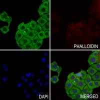ABCG1 Rabbit Polyclonal Antibody