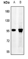 Synphilin 1 Rabbit Polyclonal Antibody