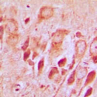 Synphilin 1 Rabbit Polyclonal Antibody