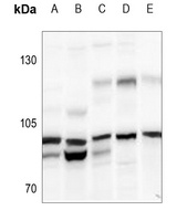N4BP1 Rabbit Polyclonal Antibody