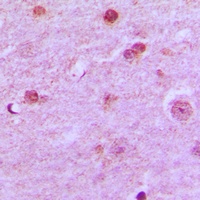 N4BP1 Rabbit Polyclonal Antibody