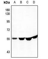 CEP57 Rabbit Polyclonal Antibody