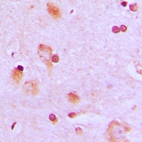CEP57 Rabbit Polyclonal Antibody