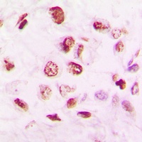Histone Deacetylase 9 Rabbit Polyclonal Antibody