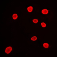 Histone Deacetylase 9 Rabbit Polyclonal Antibody
