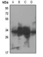 RNF144A Rabbit Polyclonal Antibody