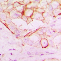 RNF144A Rabbit Polyclonal Antibody