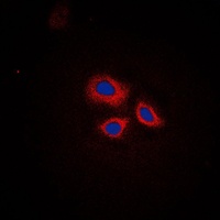 RNF144A Rabbit Polyclonal Antibody
