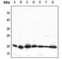 TOM20 Rabbit Polyclonal Antibody