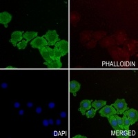 TOM20 Rabbit Polyclonal Antibody