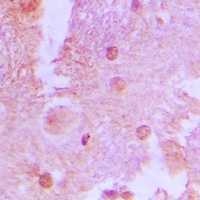 AS160 (Phospho-T642) Rabbit Polyclonal Antibody
