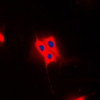 AS160 (Phospho-T642) Rabbit Polyclonal Antibody