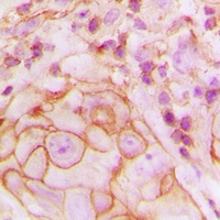 GPR105 Rabbit Polyclonal Antibody
