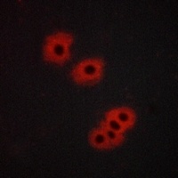 GPR105 Rabbit Polyclonal Antibody