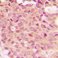Histone Deacetylase 5 (Phospho-S498) Rabbit Polyclonal Antibody