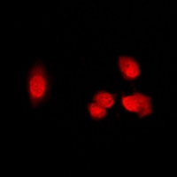 Histone Deacetylase 5 (Phospho-S498) Rabbit Polyclonal Antibody