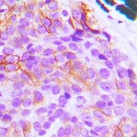 BIM Rabbit Polyclonal Antibody