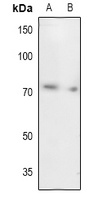 UBA2 Rabbit Polyclonal Antibody